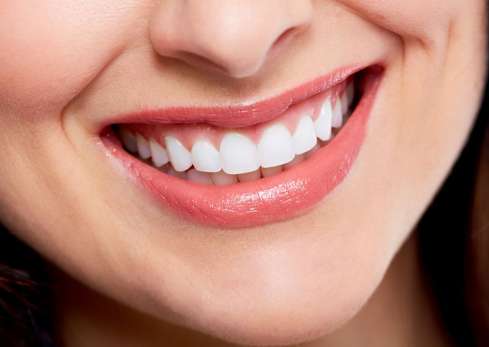 Smile Makeover with Dental Implants
