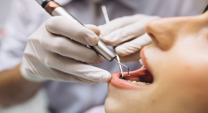 Looking for Root Canal Treatment Near Me? Here’s What You Need to Know