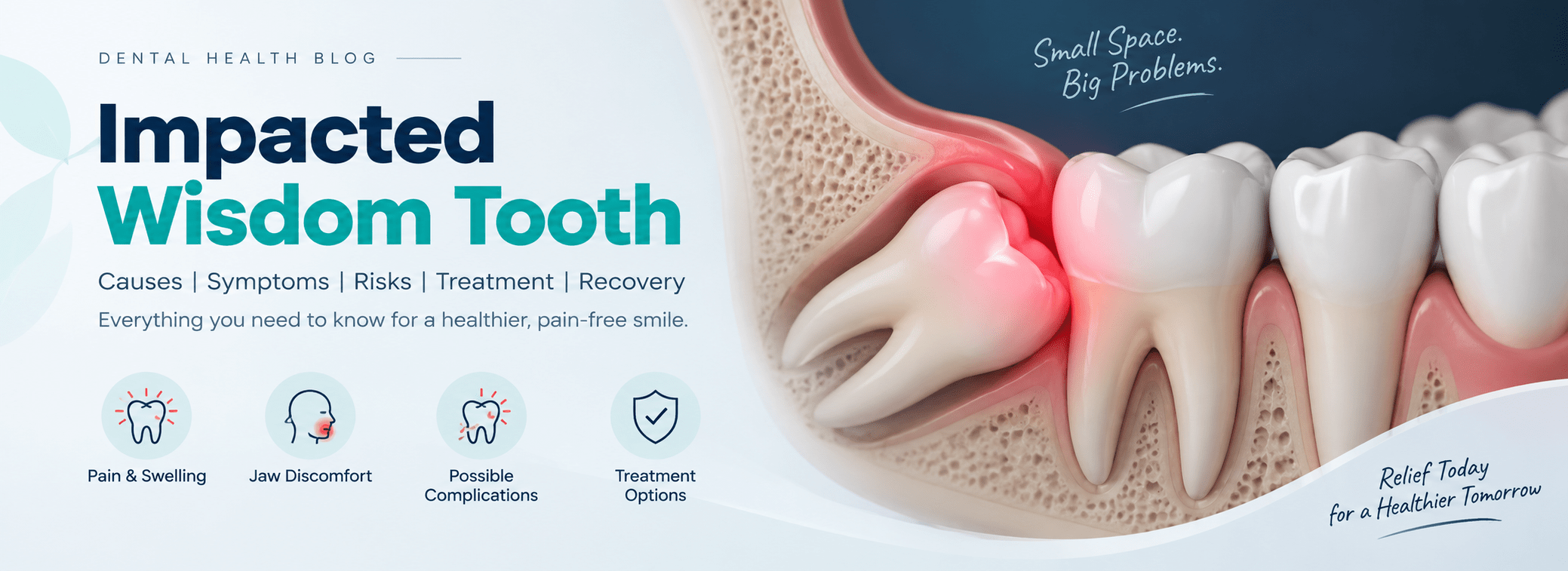 Impacted wisdom tooth symptoms and treatment illustration at Novacare Dental Kothrud Pune